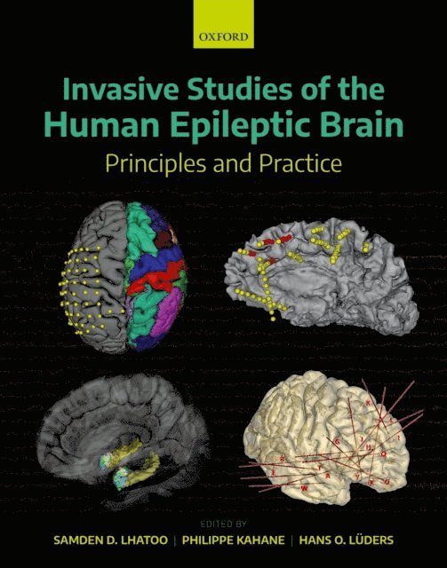 Hans O. Luders, Philippe Kahane, Samden D. Lhatoo - Invasive Studies of the Human Epileptic Brain, E-bok