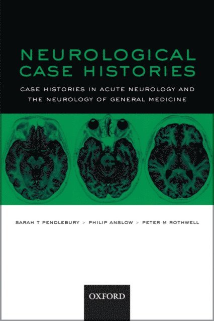 Peter M Rothwell, Philip Anslow, Sarah T Pendlebury - Neurological Case Histories, E-bok