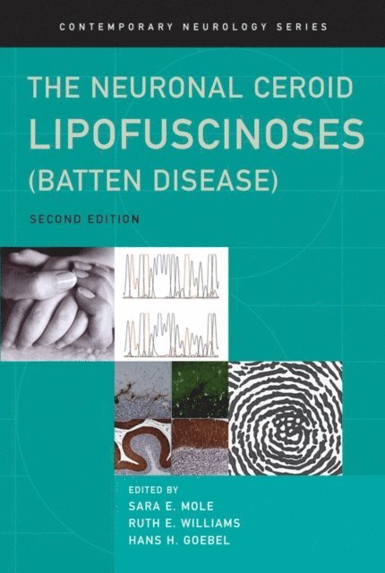 Hans Goebel, Ruth Williams, Sara Mole - Neuronal Ceroid Lipofuscinoses (Batten Disease), E-bok