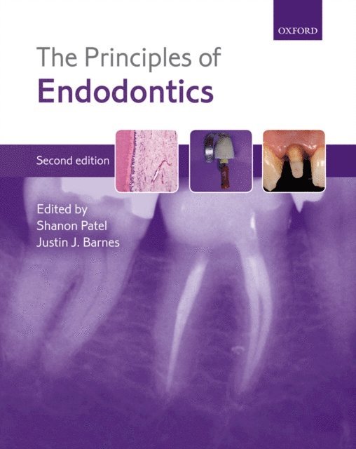 Justin J. Barnes, Shanon Patel - Principles of Endodontics, E-bok