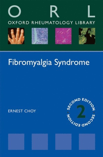 Ernest Choy - Fibromyalgia Syndrome, E-bok