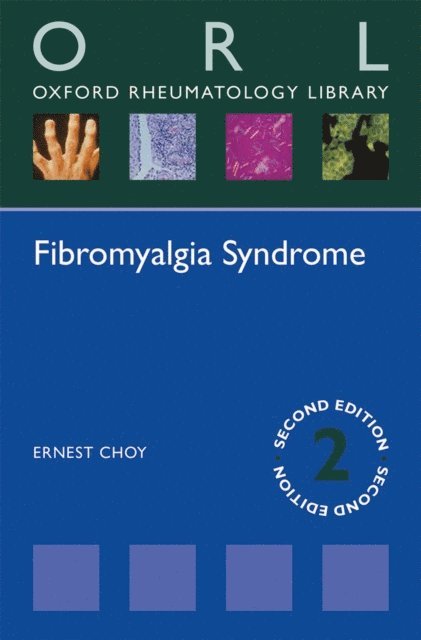 Ernest Choy - Fibromyalgia Syndrome, E-bok
