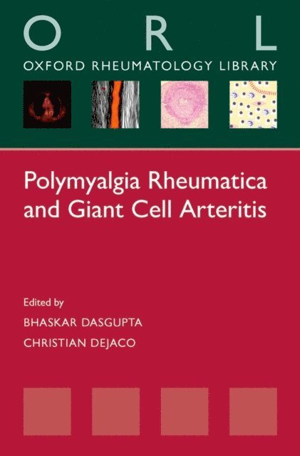 Christian Dejaco, Bhaskar Dasgupta - Polymyalgia Rheumatica and Giant Cell Arteritis, E-bok