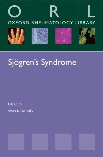 Wan-Fai Ng - SjA gren's Syndrome, E-bok