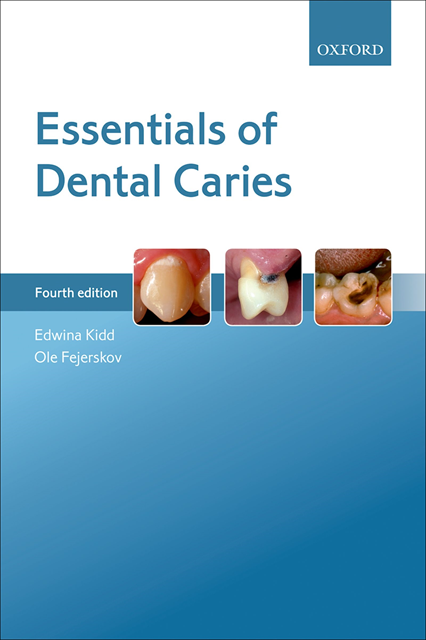 Ole Fejerskov, Edwina Kidd - Essentials of Dental Caries, E-bok