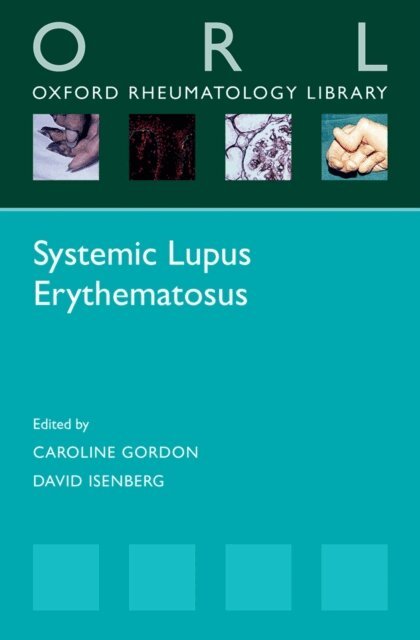 David Isenberg, Caroline Gordon - Systemic Lupus Erythematosus, E-bok