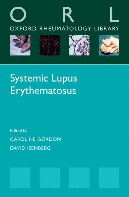 David Isenberg, Caroline Gordon - Systemic Lupus Erythematosus, E-bok