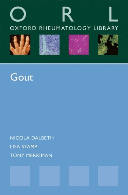 Tony Merriman, Lisa Stamp, Nicola Dalbeth - Gout, E-bok