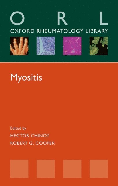 Robert G. Cooper, Hector Chinoy - Myositis, E-bok