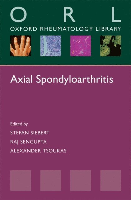 Alexander Tsoukas, Raj Sengupta, Stefan Siebert - Axial Spondyloarthritis, E-bok