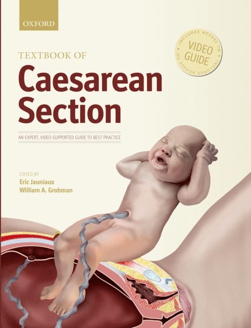 William Grobman, Eric Jauniaux - Textbook of Caesarean Section, E-bok