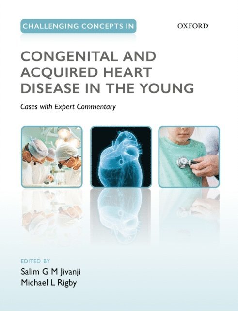 Michael Rigby, Salim Jivanji - Challenging Concepts in Congenital and Acquired Heart Disease in the Young, E-bok