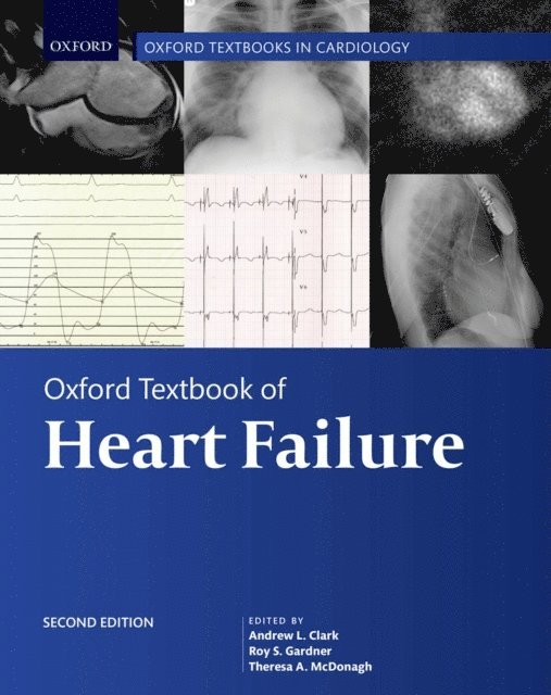 Theresa McDonagh, Roy Gardner, Andrew Clark - Oxford Textbook of Heart Failure, E-bok