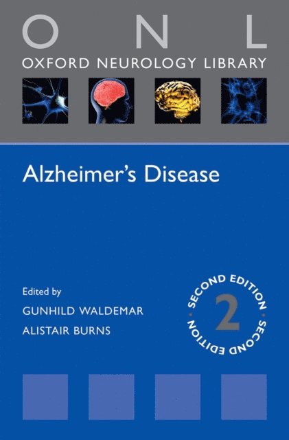 Alistair Burns, Gunhild Waldemar - Alzheimer's Disease, E-bok