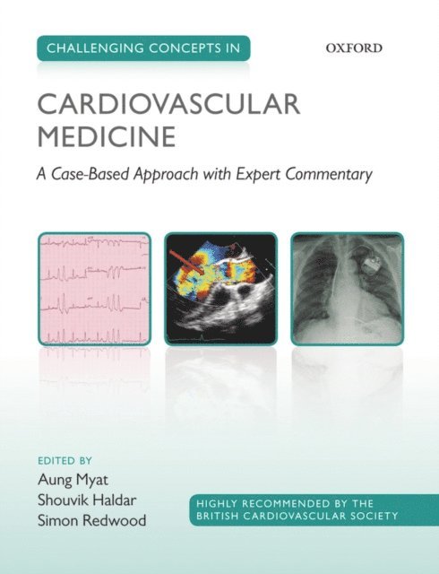 Simon Redwood, Shouvik Haldar, Aung Myat - Challenging Concepts in Cardiovascular Medicine, E-bok
