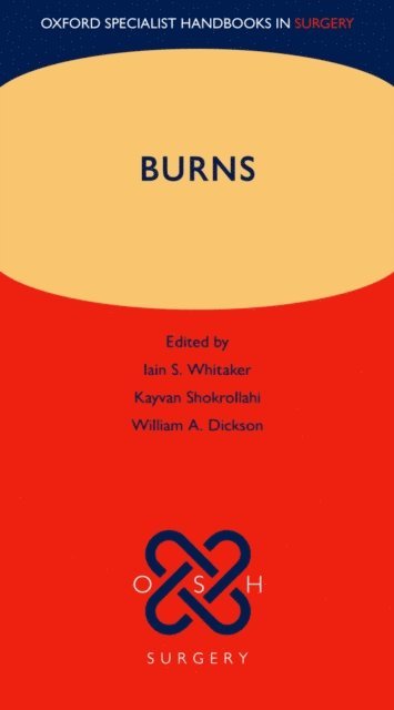 William A. Dickson, Kayvan Shokrollahi, Iain S. Whitaker - Burns, E-bok