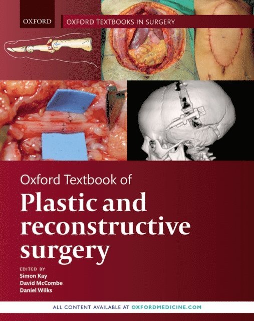 Daniel Wilks, David McCombe, Simon Kay - Oxford Textbook of Plastic and Reconstructive Surgery, E-bok