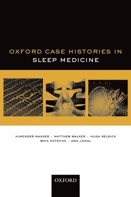 Ama Johal, Bhik Kotecha, Hugh Selsick, Matthew Walker, Himender Makker - Oxford Case Histories in Sleep Medicine, E-bok