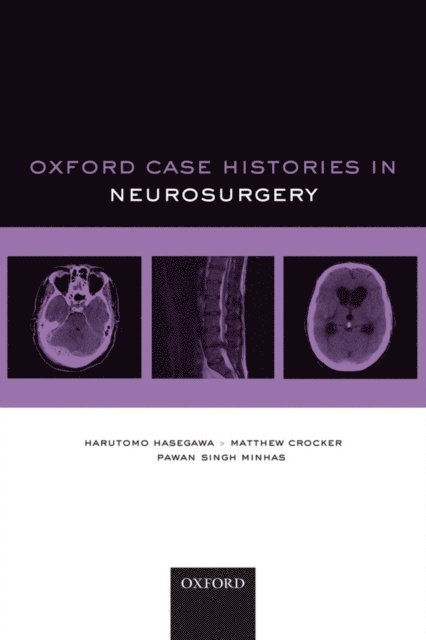 Pawan Singh Minhas, Matthew Crocker, Harutomo Hasegawa - Oxford Case Histories in Neurosurgery, E-bok