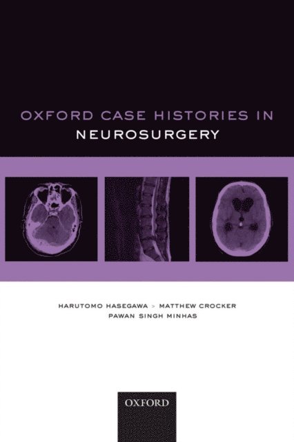 Pawan Singh Minhas, Matthew Crocker, Harutomo Hasegawa - Oxford Case Histories in Neurosurgery, E-bok