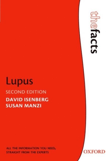 Susan Manzi, David Isenberg - Lupus, E-bok