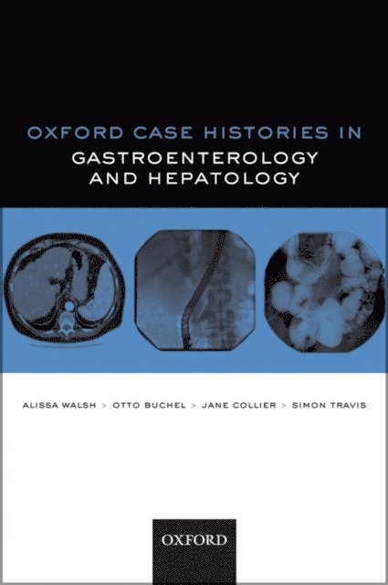 Simon P. L. Travis, Jane Collier, Otto C. Buchel, Alissa J. Walsh - Oxford Case Histories in Gastroenterology and Hepatology, E-bok