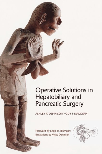 Guy J. Maddern, Ashley R. Dennison - Operative Solutions in Hepatobiliary and Pancreatic Surgery, E-bok
