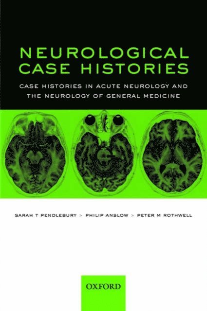 Peter M Rothwell, Philip Anslow, Sarah T Pendlebury - Neurological Case Histories, E-bok