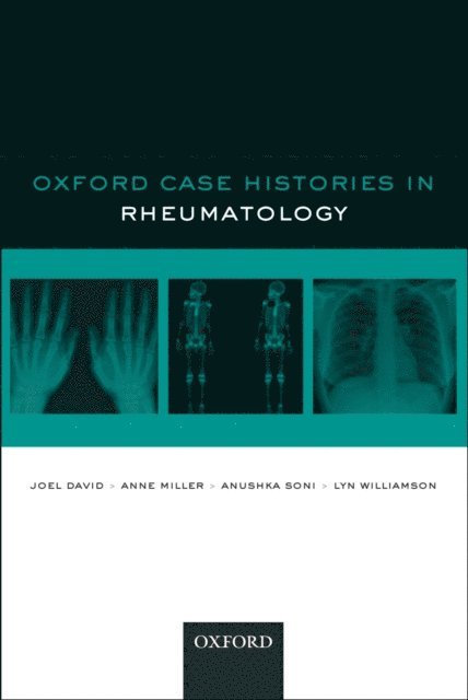 Lyn Williamson, Anushka Soni, Anne Miller, Joel David - Oxford Case Histories in Rheumatology, E-bok