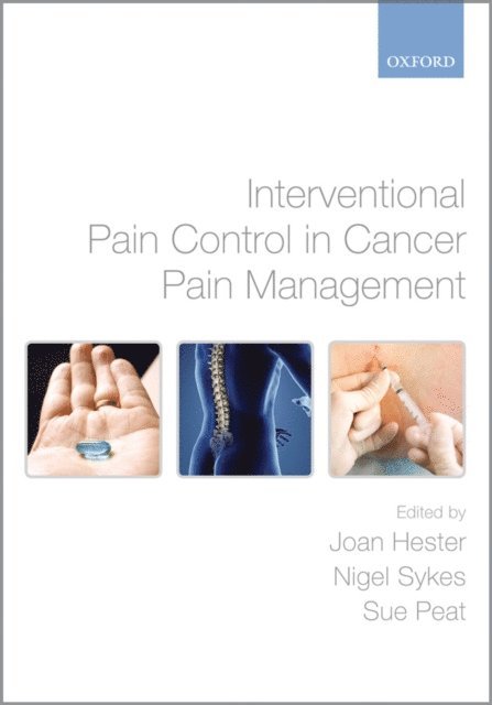 Sue Peat, Nigel Sykes, Joan Hester - Interventional Pain Control in Cancer Pain Management, E-bok