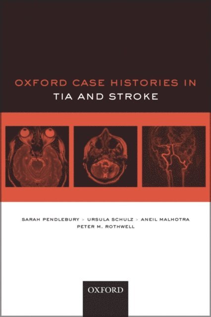 Peter M. Rothwell, Aneil Malhotra, Ursula G. Schulz, Sarah T. Pendlebury - Oxford Case Histories in TIA and Stroke, E-bok