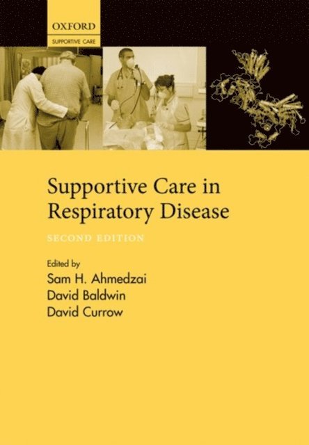 David C. Currow, David R. Baldwin, Sam H. Ahmedzai - Supportive Care in Respiratory Disease, E-bok
