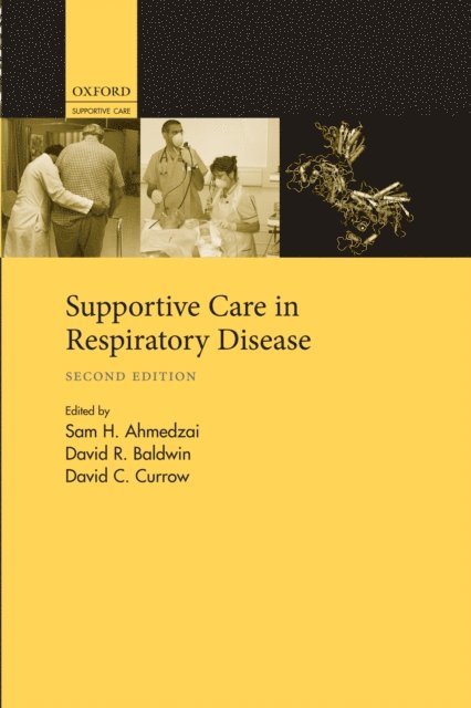 David C. Currow, David R. Baldwin, Sam H. Ahmedzai - Supportive Care in Respiratory Disease, E-bok