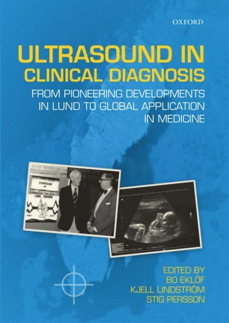 Stig Persson, Kjell Lindstrom, Bo Eklof - Ultrasound in Clinical Diagnosis, E-bok