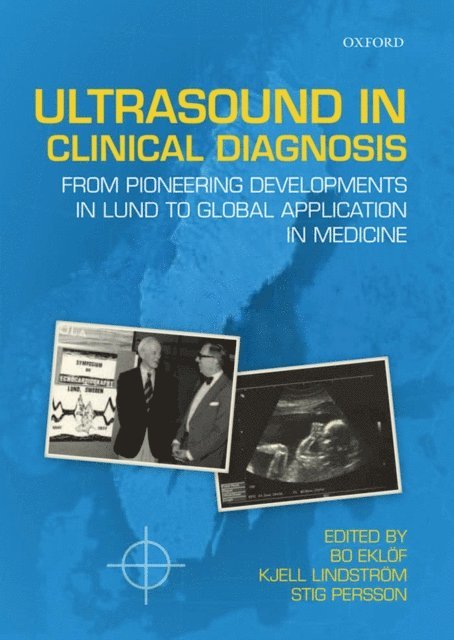 Stig Persson, Kjell Lindstrom, Bo Eklof - Ultrasound in Clinical Diagnosis, E-bok