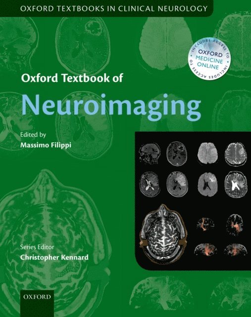 Massimo Filippi - Oxford Textbook of Neuroimaging, E-bok