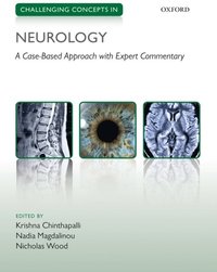 Challenging Concepts in Neurology