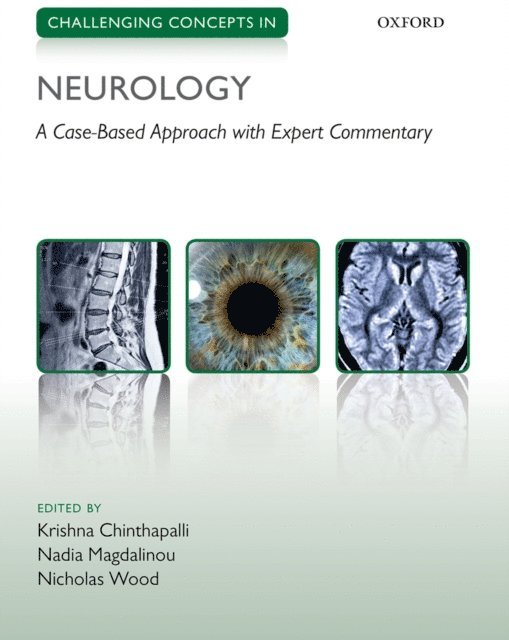 Nicholas Wood, Nadia Magdalinou, Krishna Chinthapalli - Challenging Concepts in Neurology, E-bok
