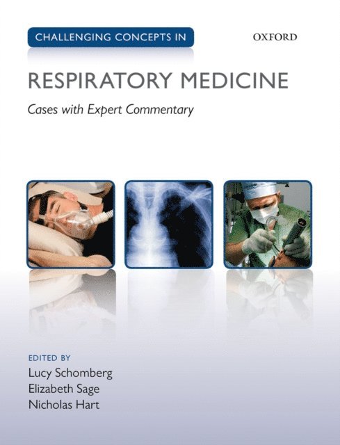 Nicholas Hart, Elizabeth Sage, Lucy Schomberg - Challenging Concepts in Respiratory Medicine, E-bok