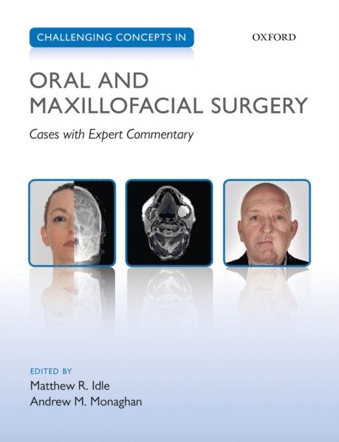 Andrew M. Monaghan, Matthew R. Idle - Challenging Concepts in Oral and Maxillofacial Surgery, E-bok