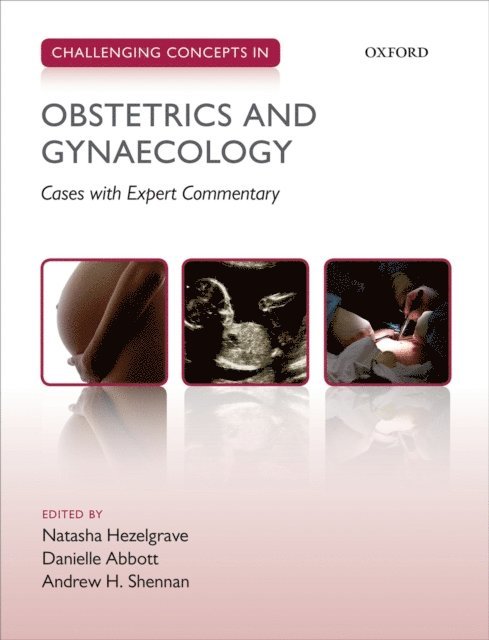 Andrew Shennan, Danielle Abbott, Natasha Hezelgrave - Challenging Concepts in Obstetrics and Gynaecology, E-bok