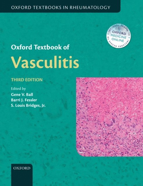 S. Louis Bridges Jr., Barri J. Fessler, Gene V. Ball - Oxford Textbook of Vasculitis, E-bok