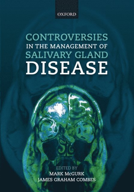 James Combes, Mark McGurk - Controversies in the Management of Salivary Gland Disease, E-bok
