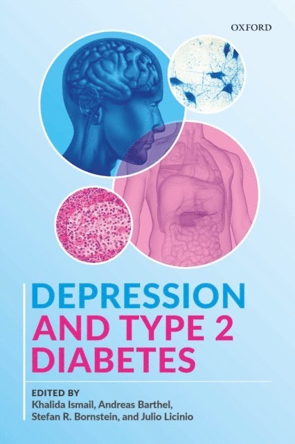 Julio Licinio, Stefan R. Bornstein, Andreas Barthel, Khalida Ismail - Depression and Type 2 Diabetes, E-bok