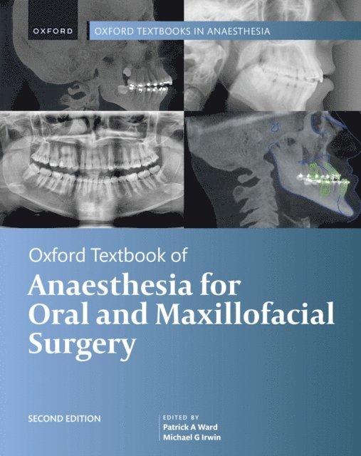 Michael G. Irwin, Patrick A. Ward - Oxford Textbook of Anaesthesia for Oral and Maxillofacial Surgery, E-bok. Tillgänglighet: Lägg i varukorg