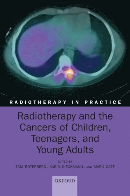 Mark Gaze, Karin Dieckmann, Tom Boterberg - Radiotherapy and the Cancers of Children, Teenagers, and Young Adults, E-bok