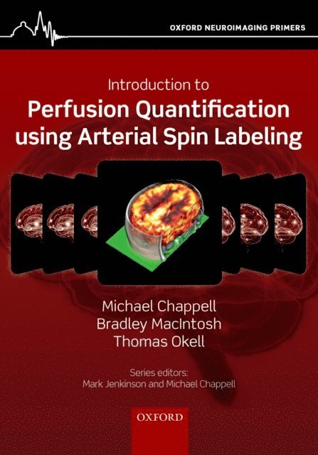 Thomas Okell, Bradley MacIntosh, Michael Chappell - Introduction to Perfusion Quantification using Arterial Spin Labelling, E-bok