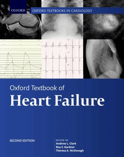Theresa McDonagh, Roy Gardner, Andrew Clark - Oxford Textbook of Heart Failure, E-bok