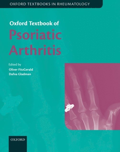 Dafna Gladman, Oliver FitzGerald - Oxford Textbook of Psoriatic Arthritis, E-bok