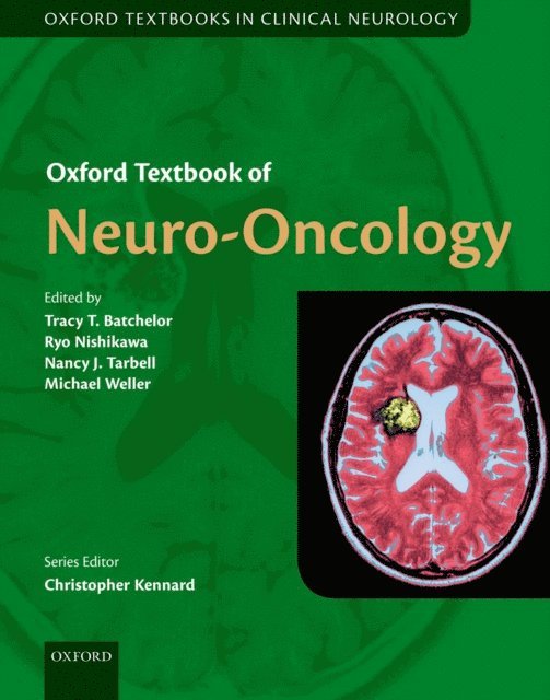 Michael Weller, Nancy Tarbell, Ryo Nishikawa, Tracy Batchelor - Oxford Textbook of Neuro-Oncology, E-bok